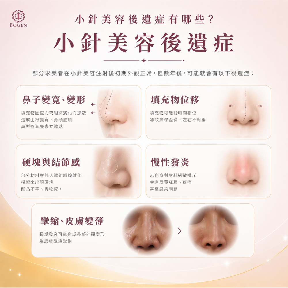 後遺症,小針美容後遺症,王彩樺,攣縮鼻,紅腫發炎